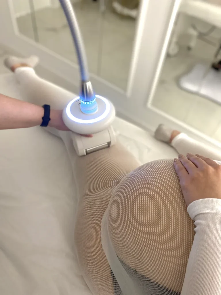 endermologia radom opinie