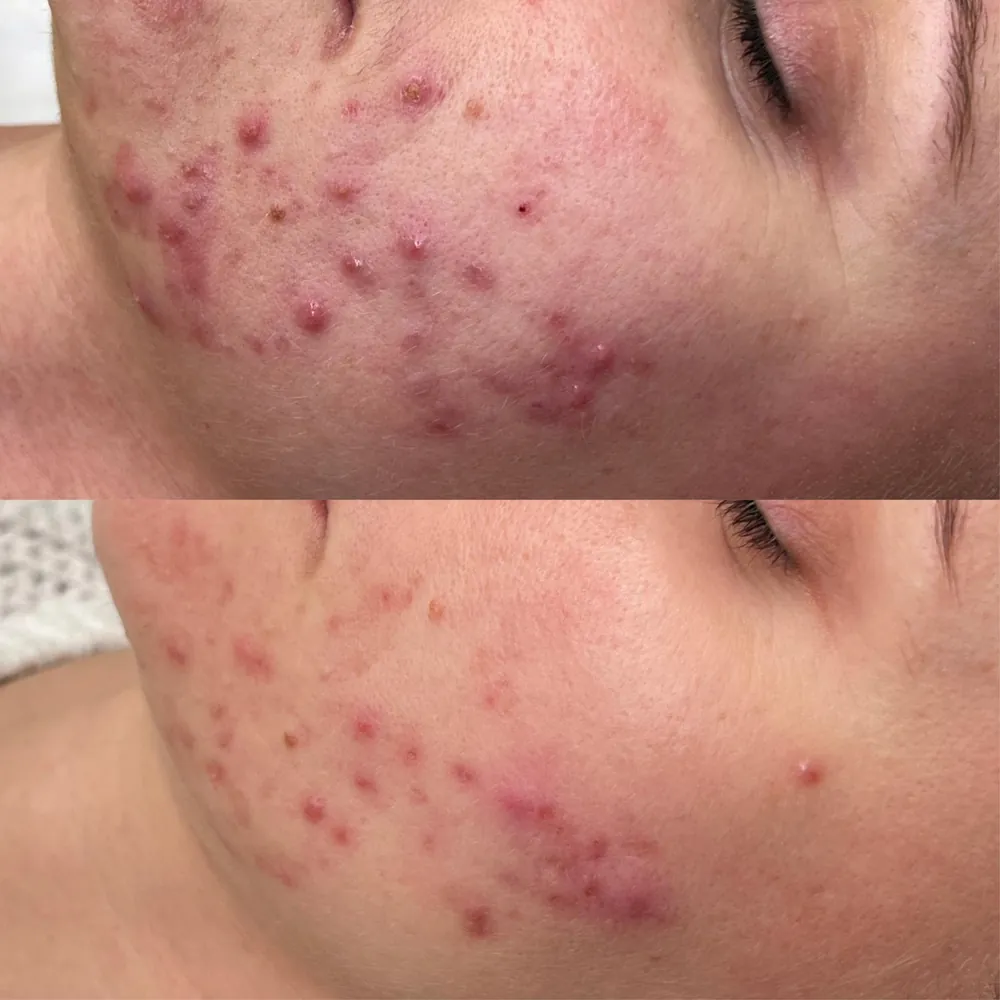 69ddf222-fb2d-4c79-9b8b-05d750be5cea