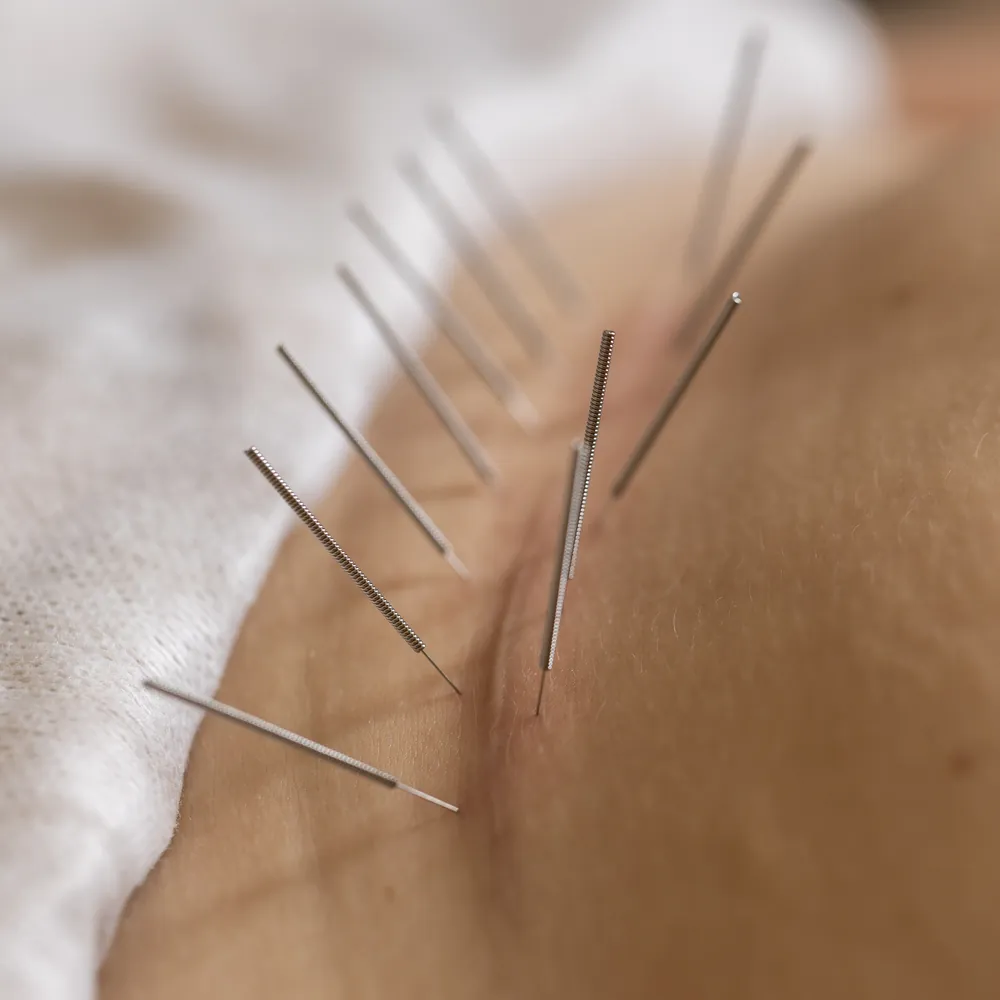 Kopia _T1A1349 kopia