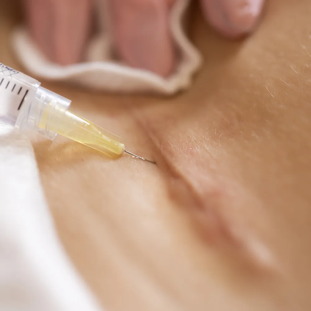 Kopia _T1A1361 kopia