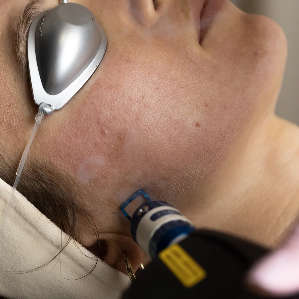 Kopia _T1A1631 kopia