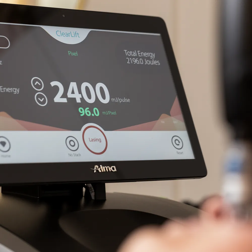 Kopia _T1A3212 kopia