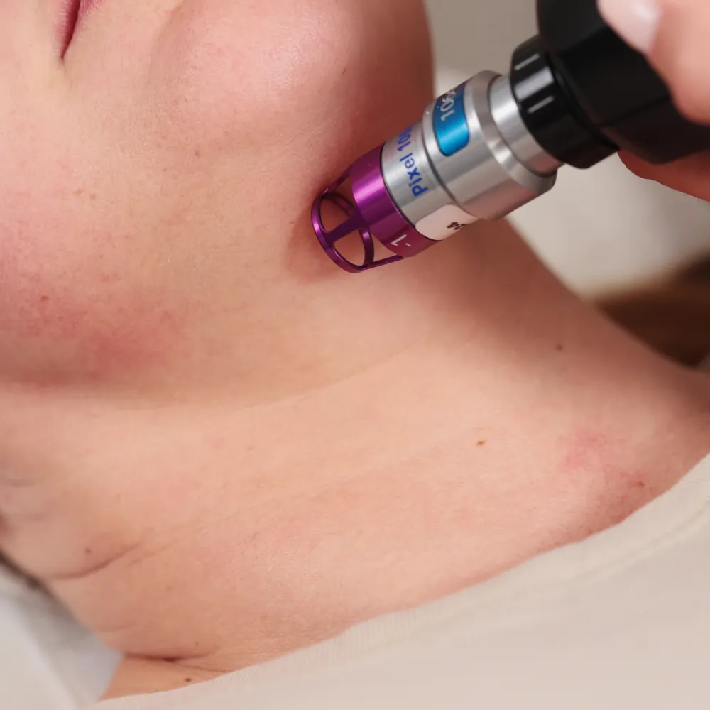 Kopia _T1A4714 kopia