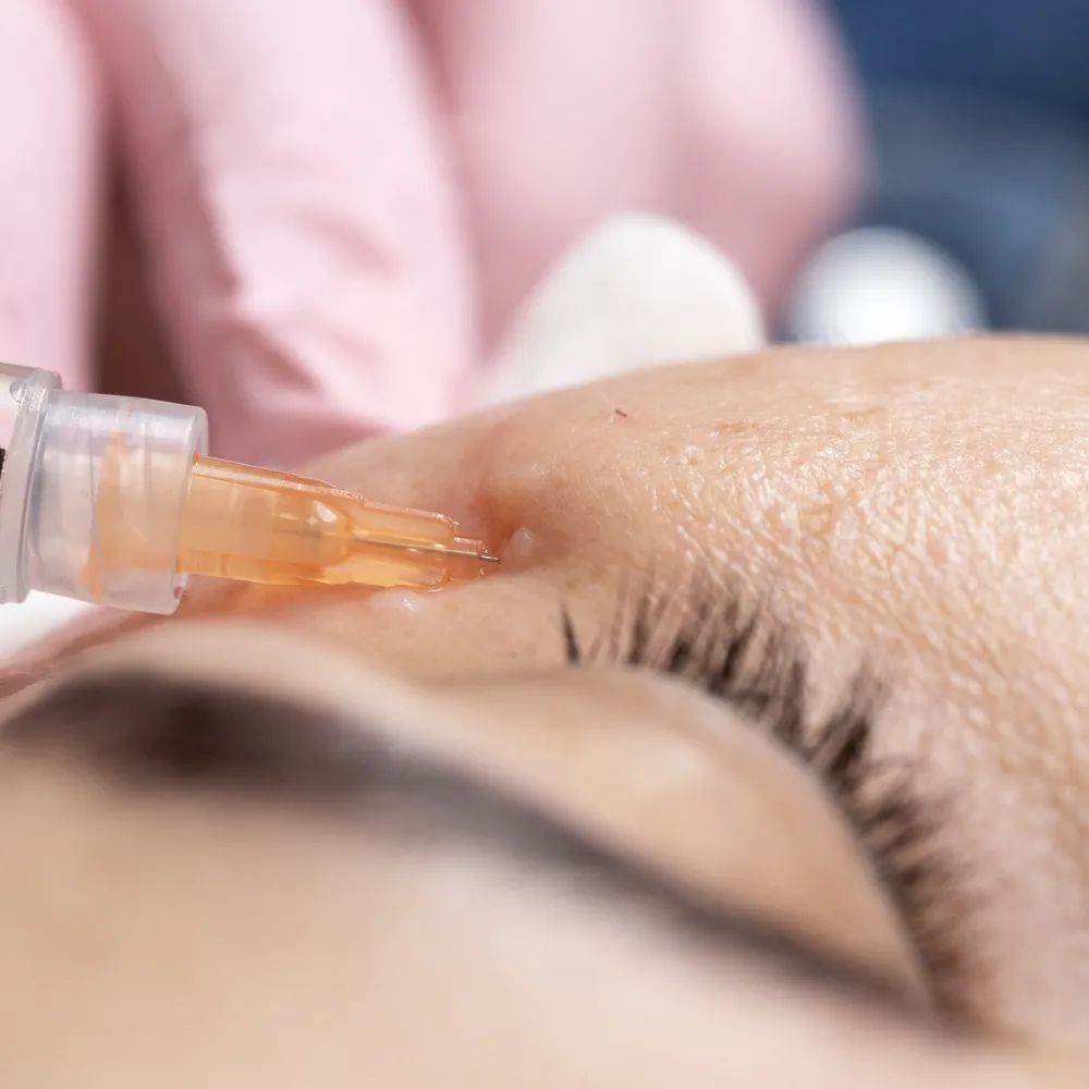 Kopia _T1A5047 kopia