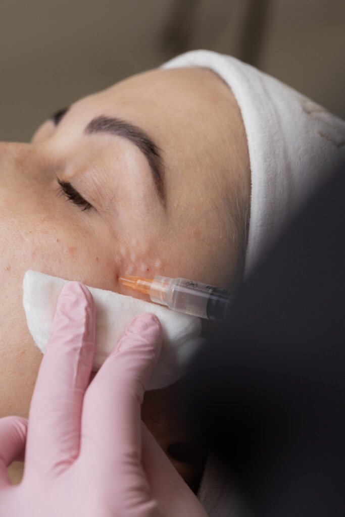 Mezoterapia Radom
