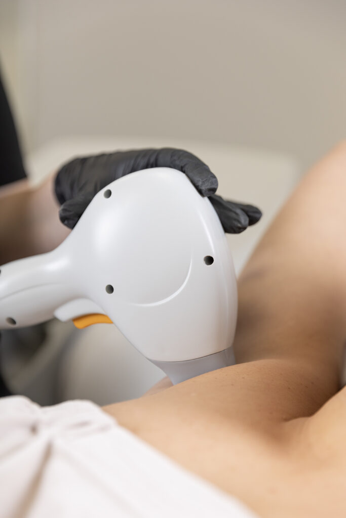 depilacja laserowa warszawa