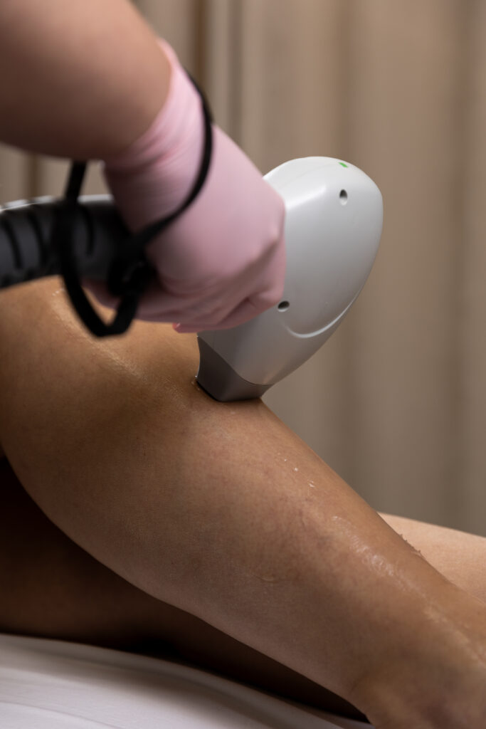 depilacja laserowa radom