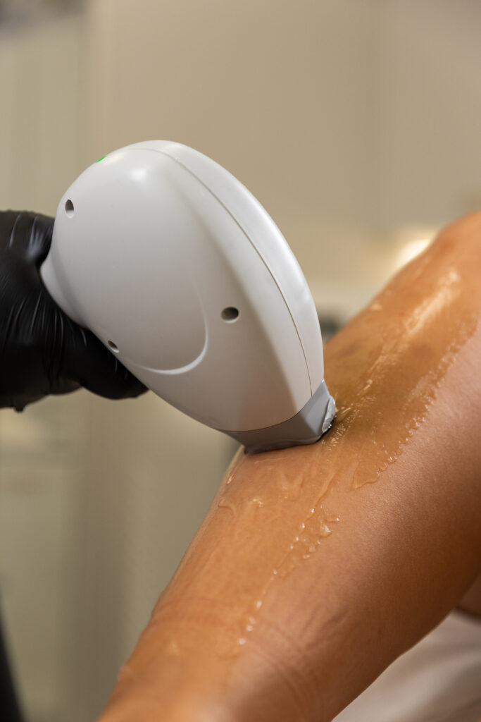 nowoczesna epilacja laserowa urządzenie z chłodzeniem komfort zabiegu