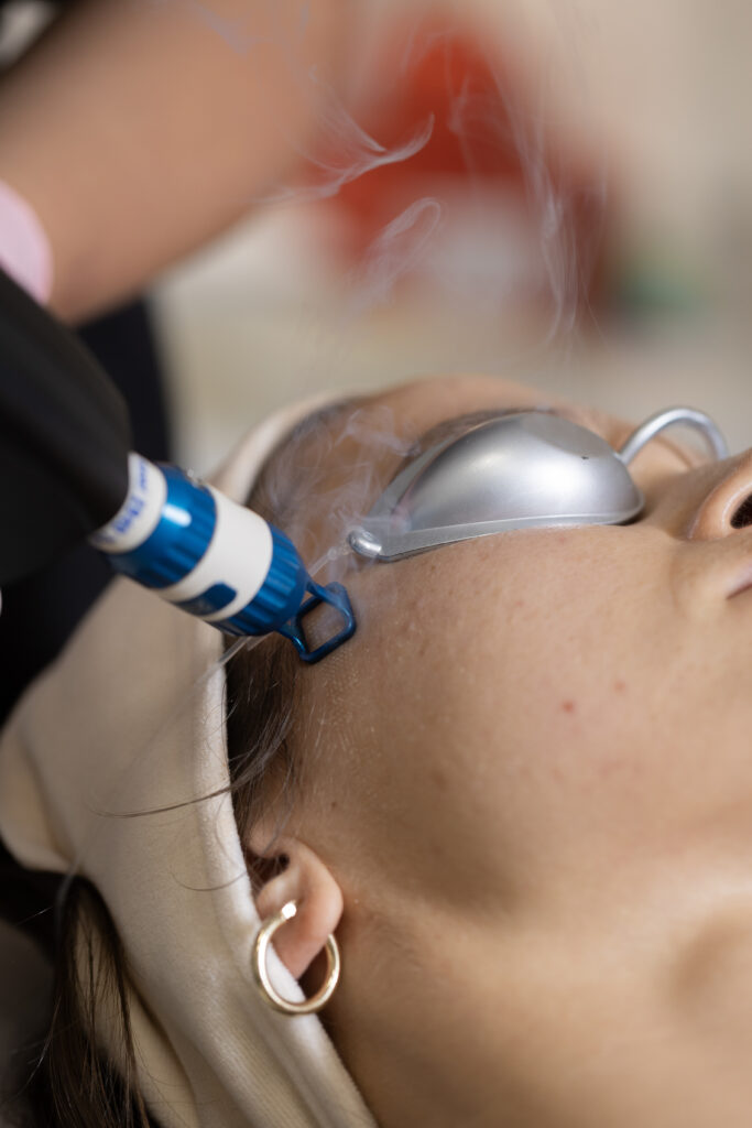 rumień i popękane naczynka na twarzy nos policzki przyczyny problemu